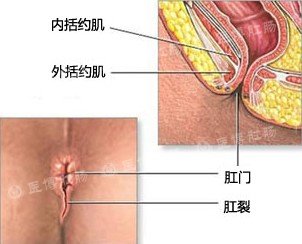 便血鲜红一大滩