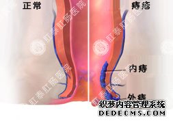 福州肛肠医院