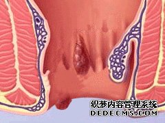 福州肛肠医院