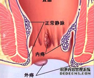 福州肛肠医院 福州医博肛肠医院 福州看痔疮的医院 福州肛瘘医院 福州肛裂医院 福州肠炎医院