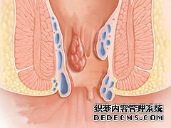 福州肛肠医院 福州医博肛肠医院 福州看痔疮的医院 福州肛瘘医院 福州肛裂医院 福州肠炎医院