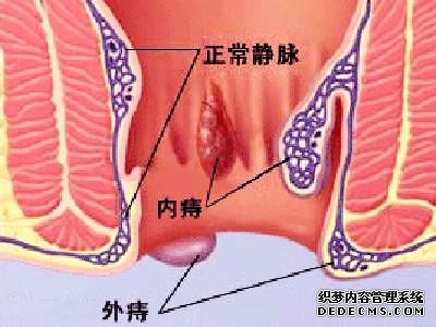 福州肛肠医院