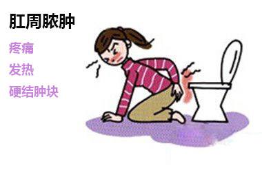 肛门脓肿怎么治效果果好