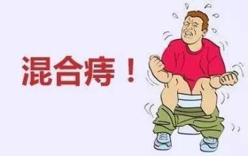 福州治疗混合痔大概多少钱